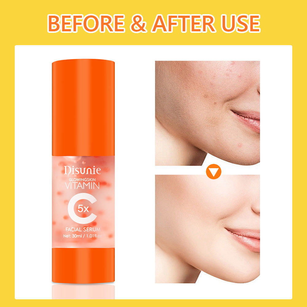 Vitamin C Facial Serum