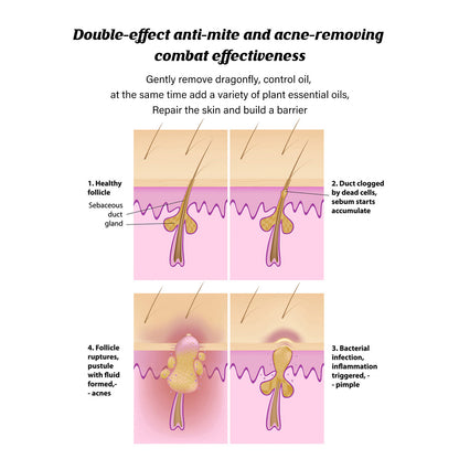 Acne Inhibiting Cleansing Mite Handmade Soap