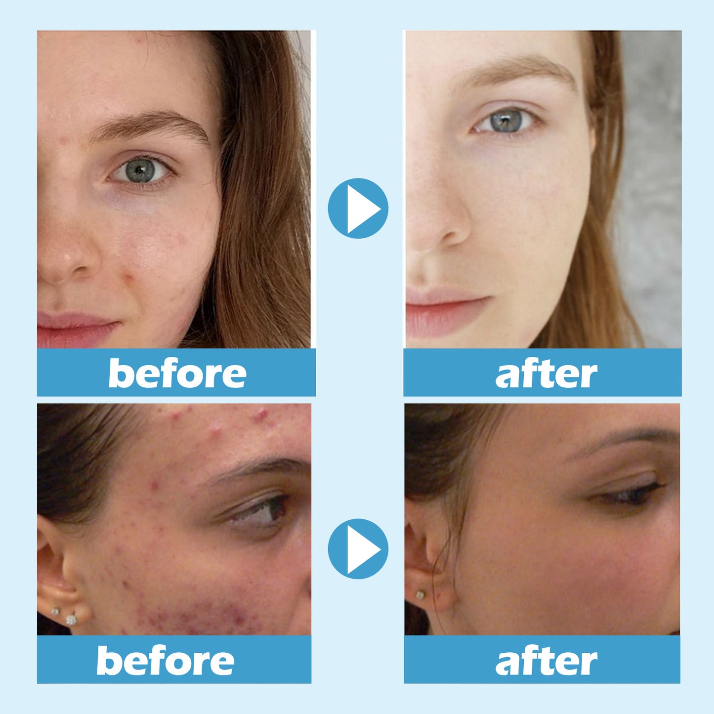 Deep Cleaning Pore Moisturizing Facial Mask