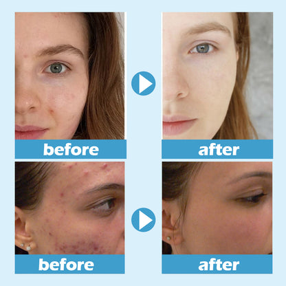Deep Cleaning Pore Moisturizing Facial Mask